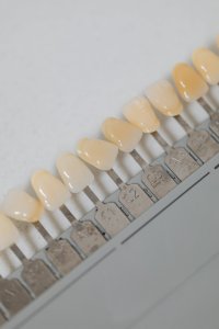 Sample dental implants
