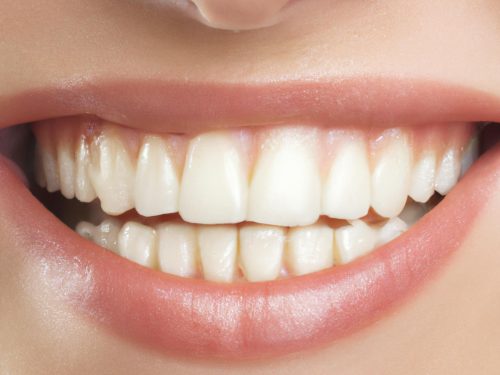 Confident Smile from Creekside Dental